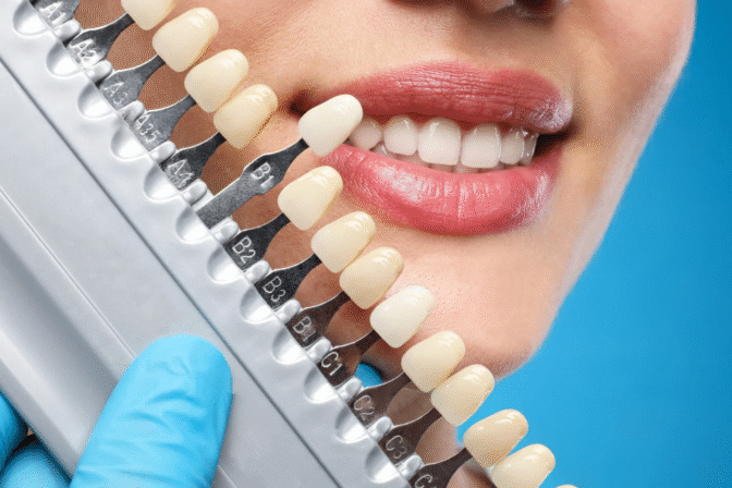 L’importanza della diagnosi precoce: Come VELscope può salvare il tuo sorriso